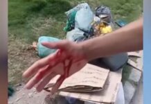 Grave acidente com gari em Campo Formoso acende alerta sobre descarte irregular de vidro